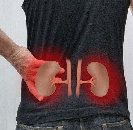 Lows Schmerzen können bei Pyelonephritis auftreten