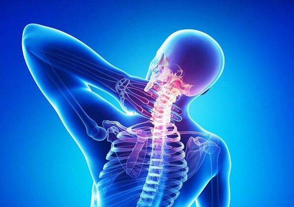 Halsspalte mit Osteochondrose