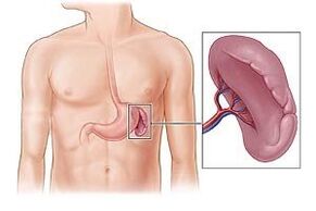 Pathologie der Milz als Ursache für Schmerzen unter dem linken Schulterblatt